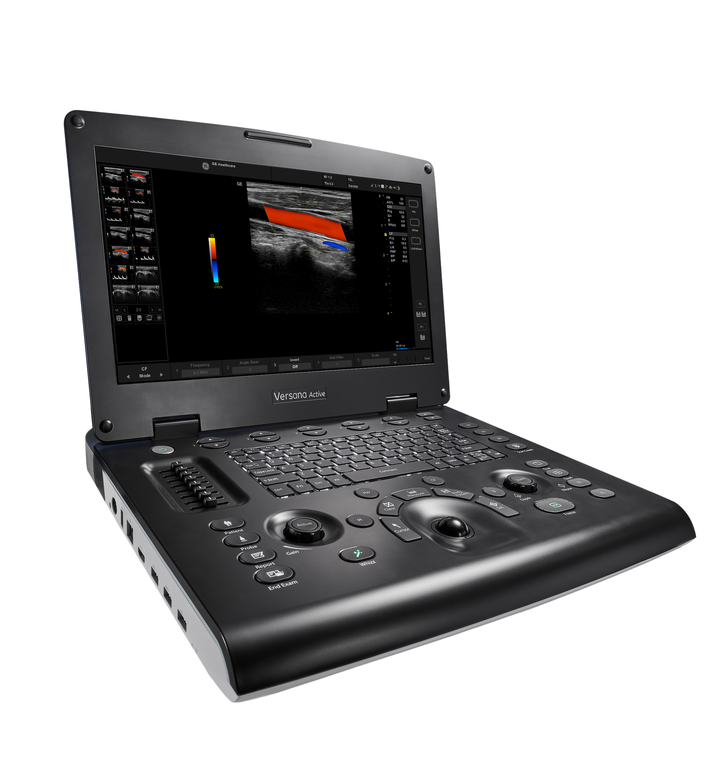 GE Versana Active Ultrasound System