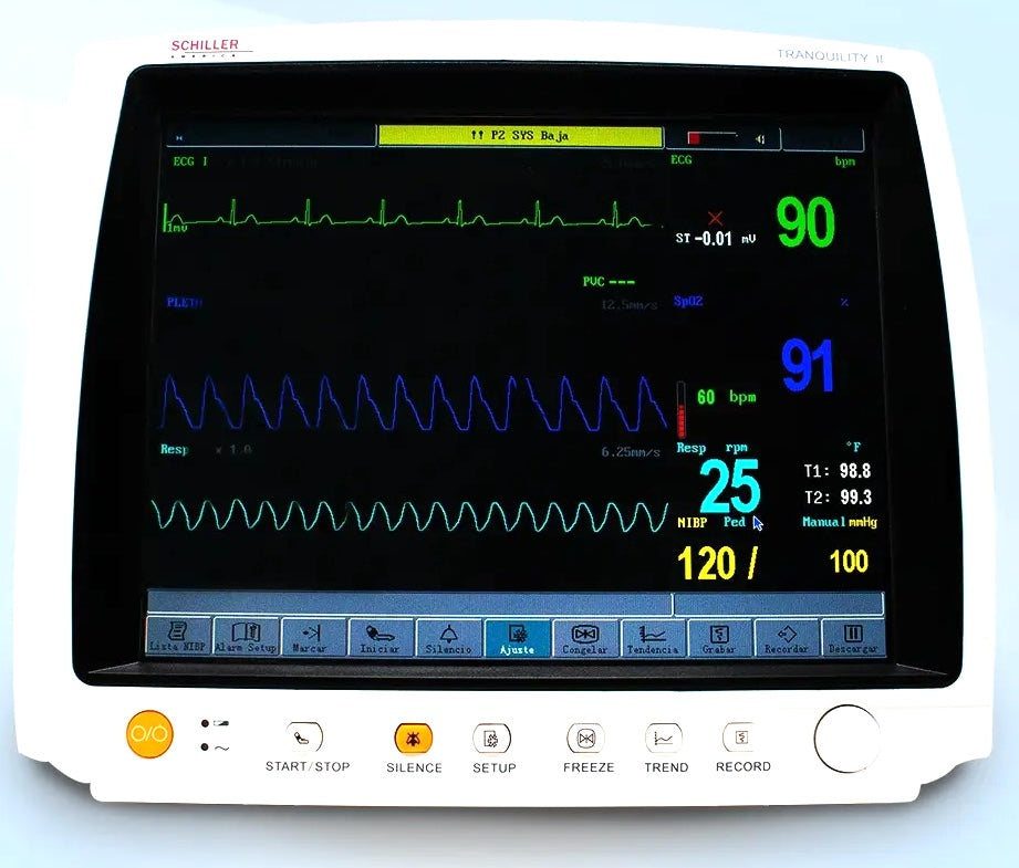 Tranquility II Multi-Parameter Patient Monitor w/ ETCO2. Masimo SpO2
