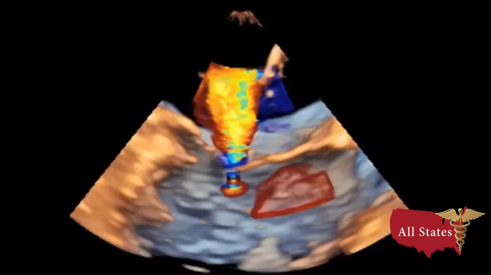 GE VIVID IQ Refurbished with 2 Probes