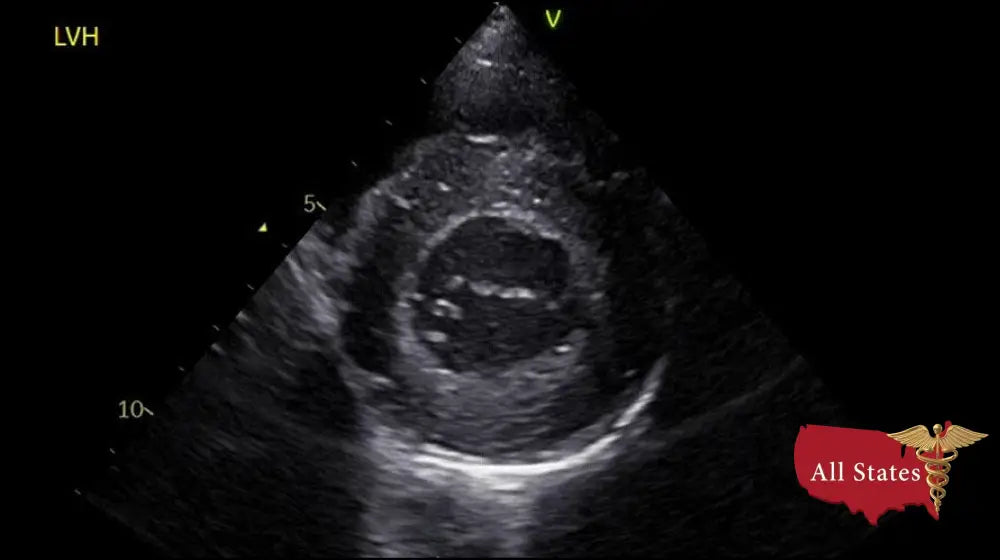 GE Vivid IQ Ultra Edition v206 Portable Ultrasound