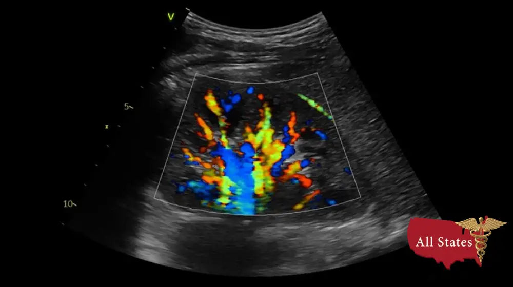 GE Vivid IQ Ultra Edition v206 Portable Ultrasound