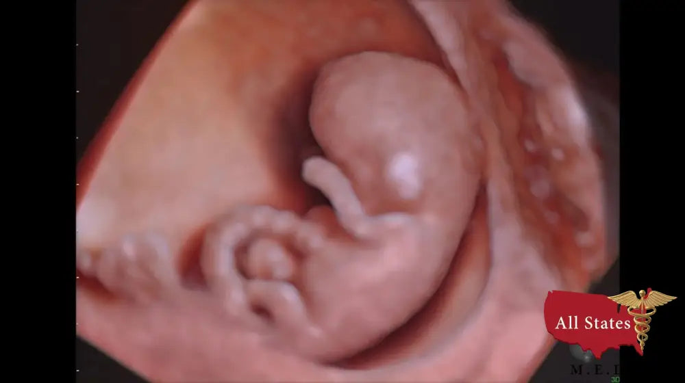 GE VOLUSON E8 Refurbished WITH 3 Probes