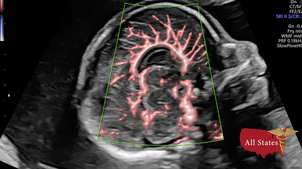 GE VOLUSON E8 Refurbished WITH 3 Probes