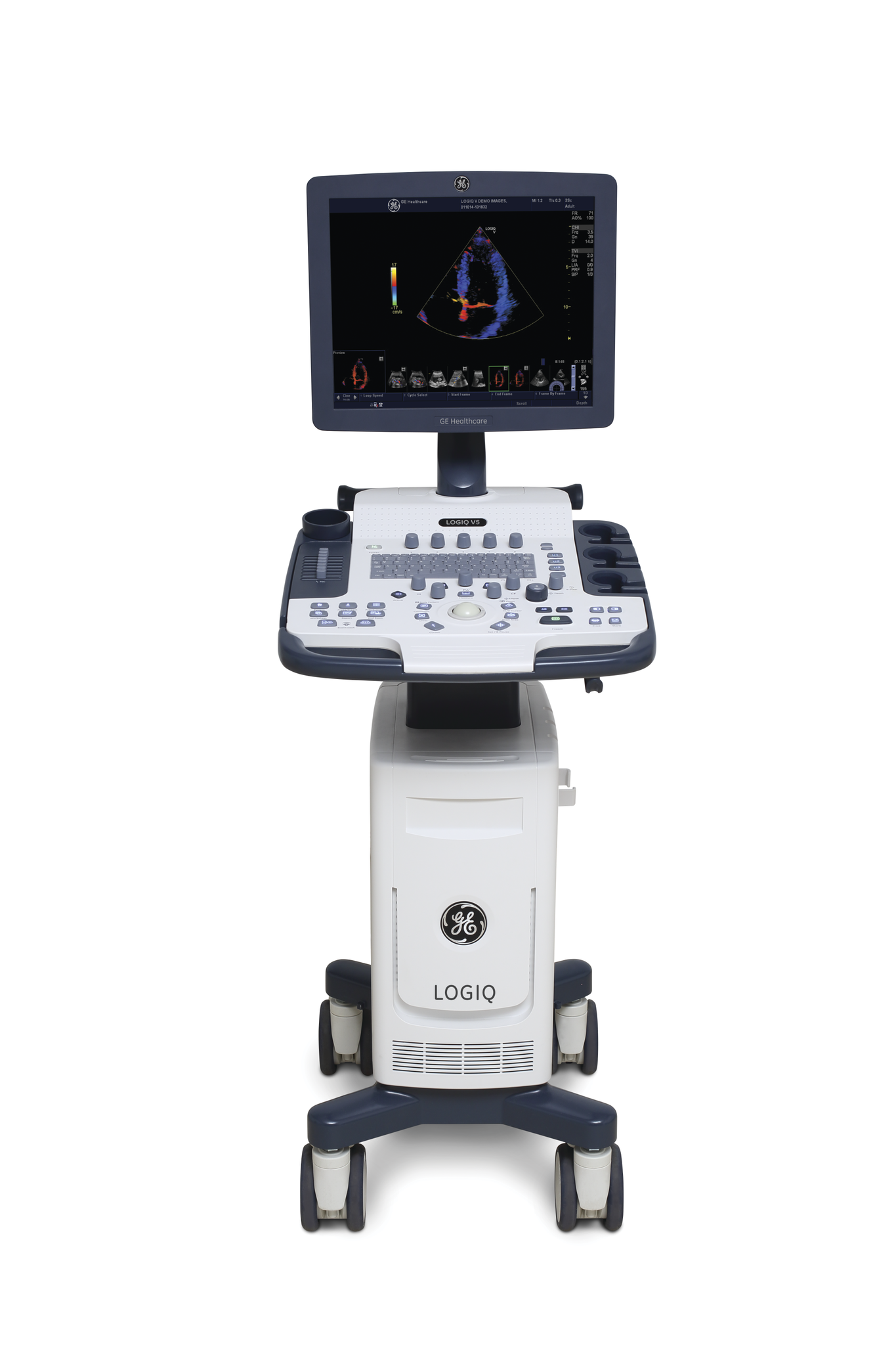 GE LOGIQ V5 Ultrasound System