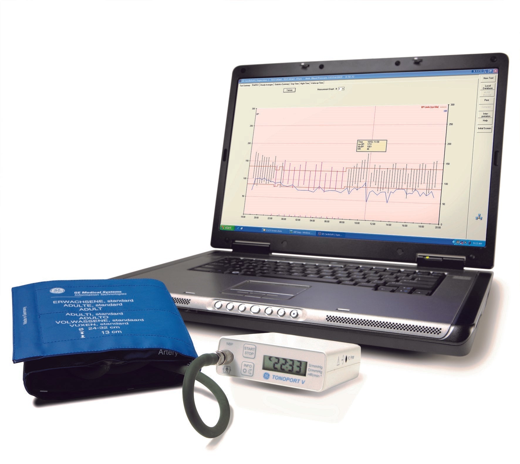 GE TONOPORT V Ambulatory Blood Pressure System & Cardiosoft Diagnostic System