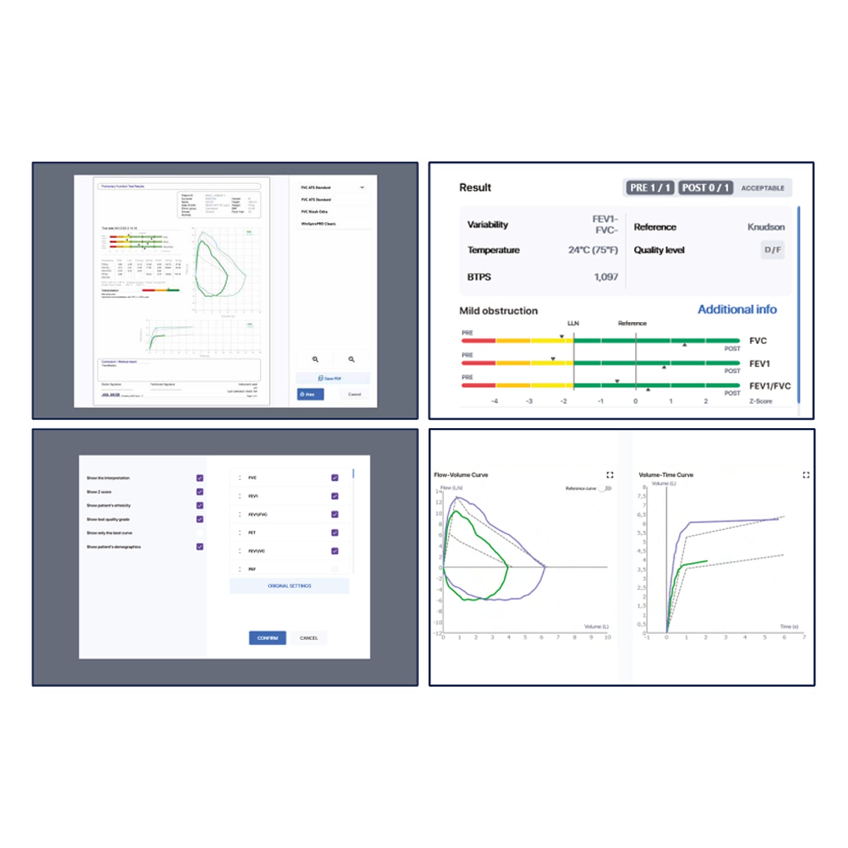 Minispir Handheld USB Spirometer