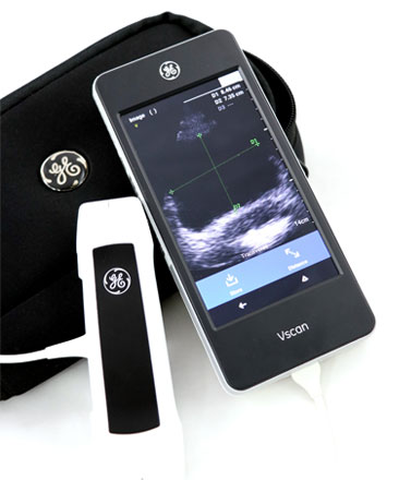 GE Vscan Extend R2 with Sector Probe Ultrasound System