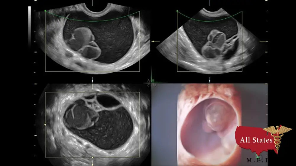 GE VOLUSON E8 Refurbished WITH 3 Probes