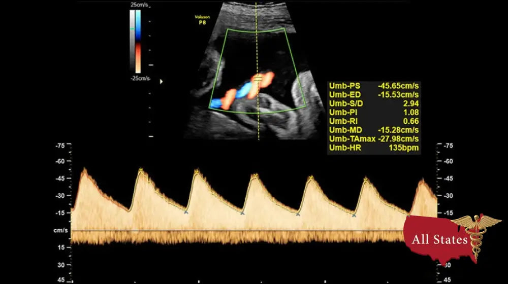 GE VOLUSON P8 BT16 Refurbished WITH 3 Probes