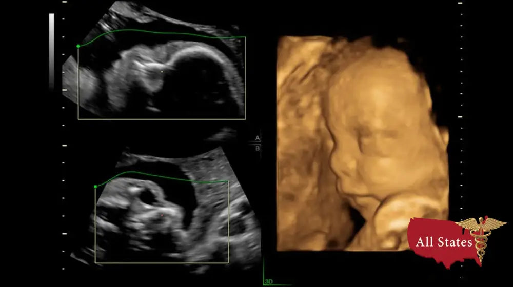 GE VOLUSON P8 BT16 Refurbished WITH 3 Probes