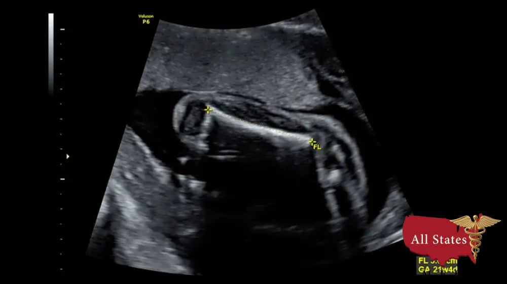 GE VOLUSON P8 BT16 Refurbished WITH 3 Probes