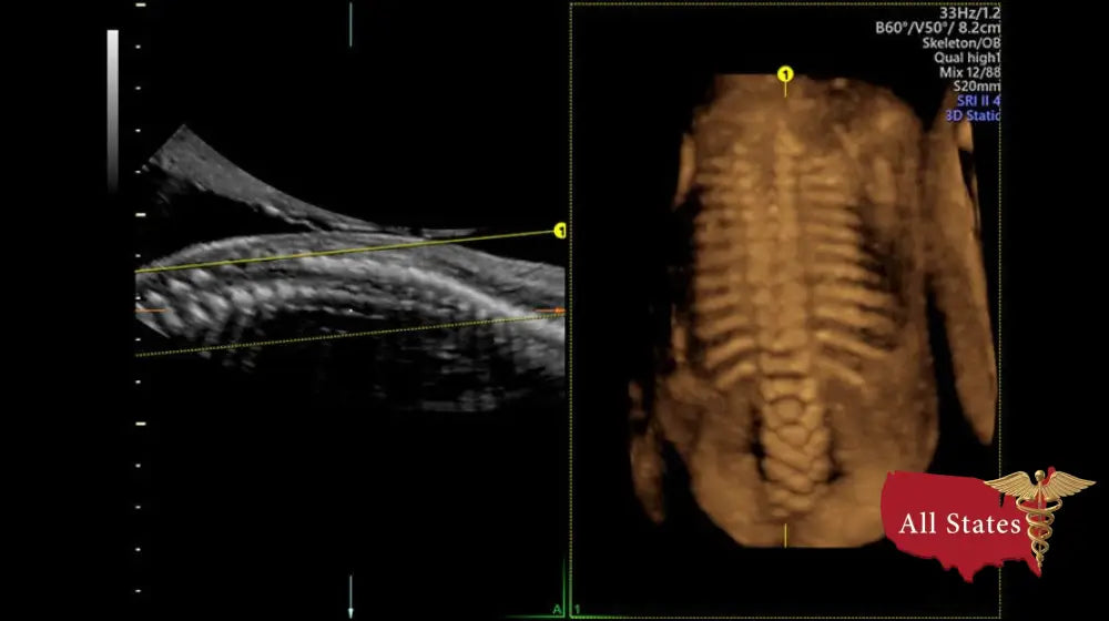 GE VOLUSON P8 BT22 Brand New