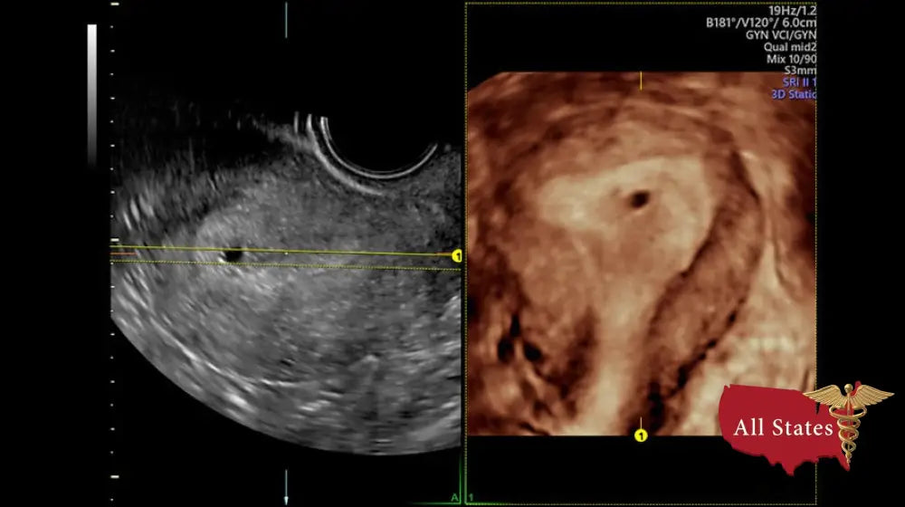 GE VOLUSON P8 BT22 Brand New