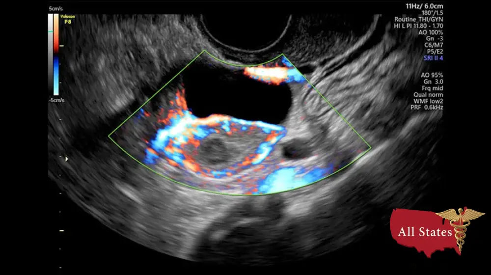 GE VOLUSON P8 BT22 Brand New