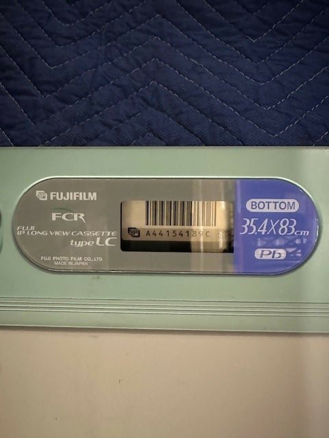 Spark Scoli X-Ray Stand w/Fujifilm Cassette (Pre-Owned)